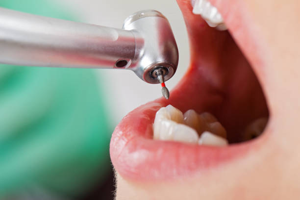 Best Emergency Broken Tooth Repair in Gaffney, SC